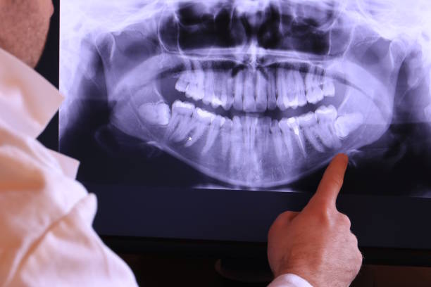 Best Emergency Dental Extractions in Unt Vernon, MO